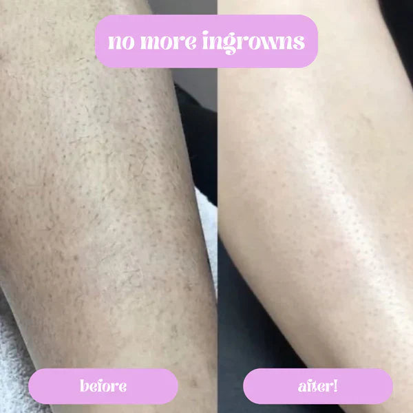 Glwme™ Razor Pro