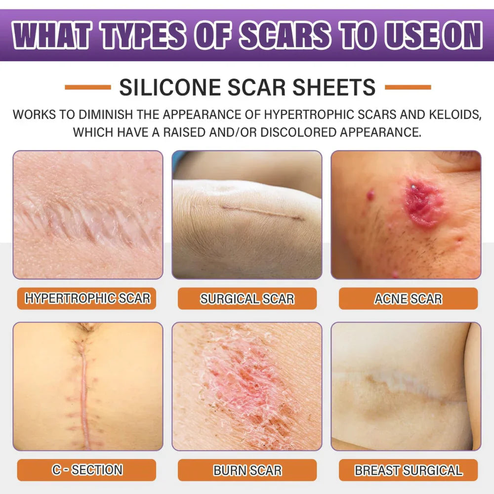 Renew Scar Tape