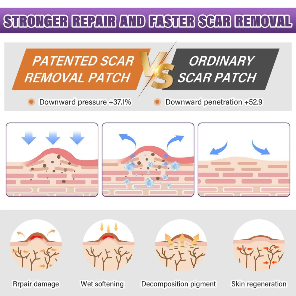 Renew Scar Tape