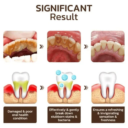 Teeth Whitening Powder | Whitening and Stain Removal